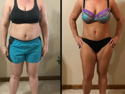 American woman insulin function support journey